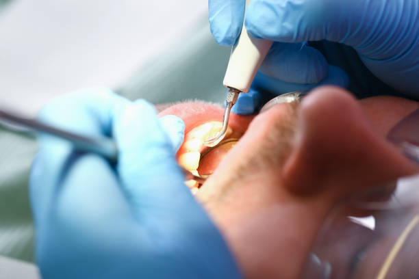 Best Emergency Treatment for Toothache in Mango, FL
